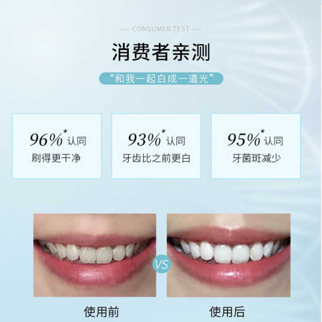 舒客 小苏打洁白护龈牙膏105g（单位：支）